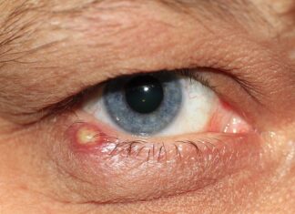 Czy słuchawki mogą powodować zapalenie ucha? Czy słuchawki mogą powodować zapalenie ucha?